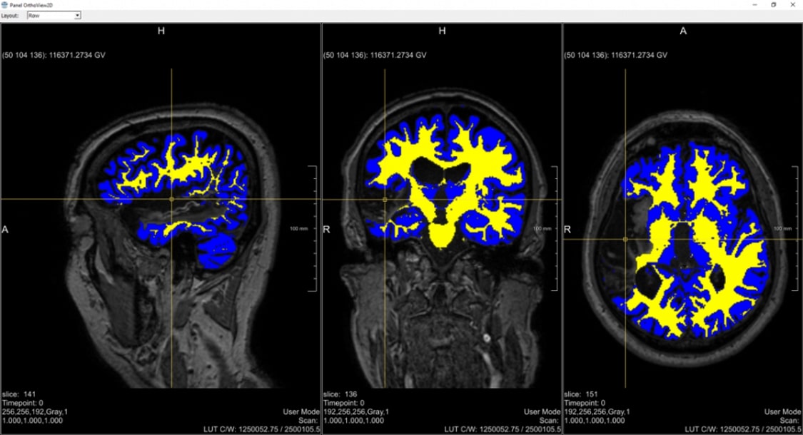 Brain Image