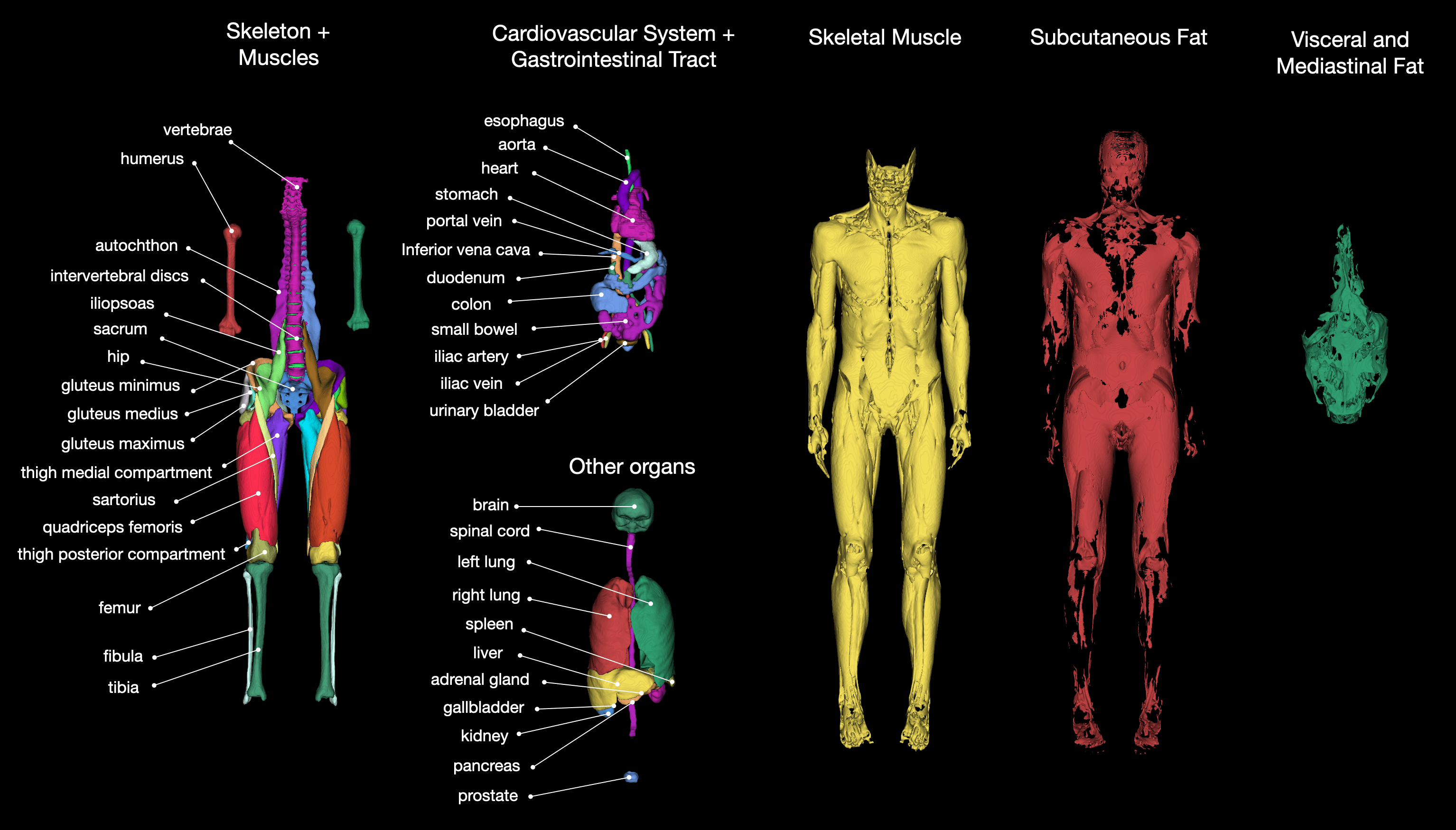 TotalSegmentatorMRI